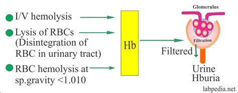 Urine Analysis: Part 9 – Hemoglobin in the urine (Hemoglobinuria ...