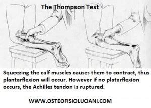 Achilles tendinopathy (or Achilles tendinitis) - Osteopata e ...