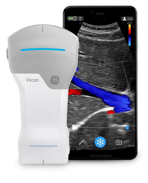 GE Vscan Air Wireless Handheld ultrasound with Dual probe