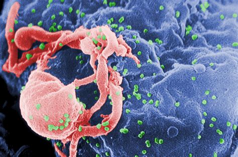 File:HIV-budding-Color.jpg - Wikipedia, the free encyclopedia