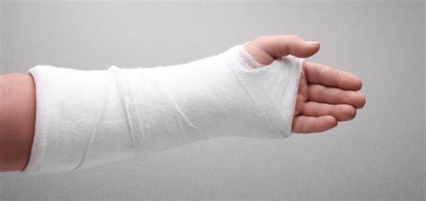 Types Of Casts: Plaster Casts, Synthetic Casts, Splints, 56% OFF