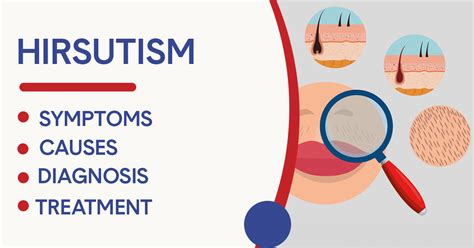 Hirsutism: Symptoms, Causes, Diagnosis, & Treatment - Jaipur Hospital