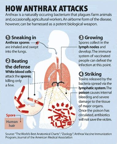 Get Aware of Anthrax Disease Their Symptoms With Natural Remedies ...