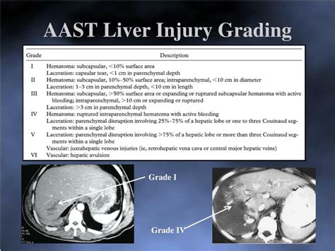 Liver Trauma Grading