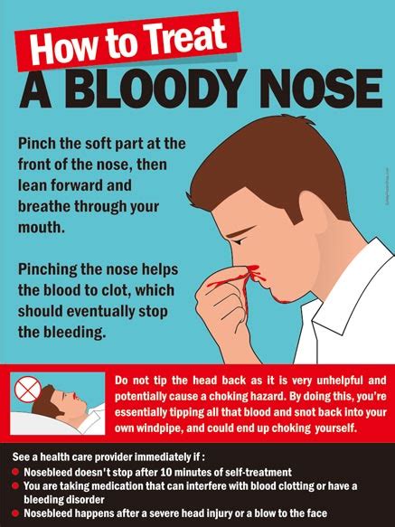 Bloody Nose Treatment Online | www.aikicai.org