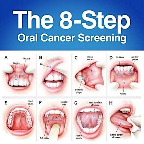 Self check-ups and what to look for - Serenity Dental