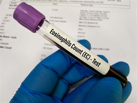 Eosinophil Count: What’s Normal for EOS Blood Test?