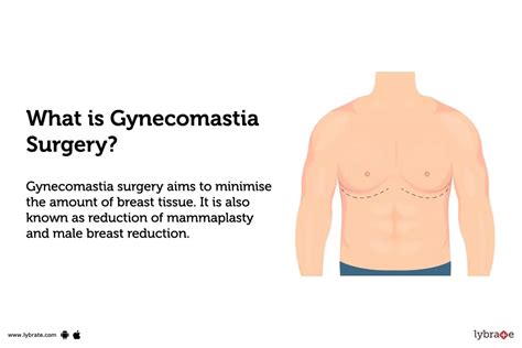 Gynecomastia Surgery: Purpose, Procedure, Benefits and Side Effects