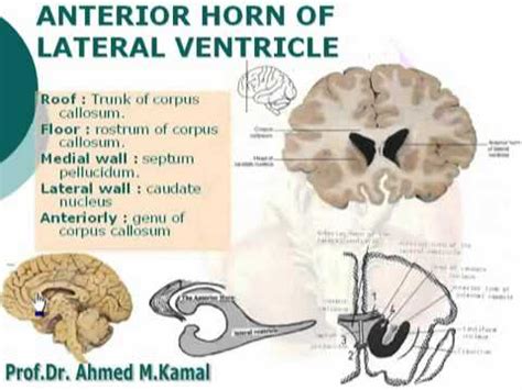 65 Anterior horn of lateral ventricle Azharmedicine com - YouTube