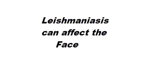 Mucocutaneous Leishmaniasis Symptoms, Pathogenesis, Diagnosis, Treatment, Images and ...