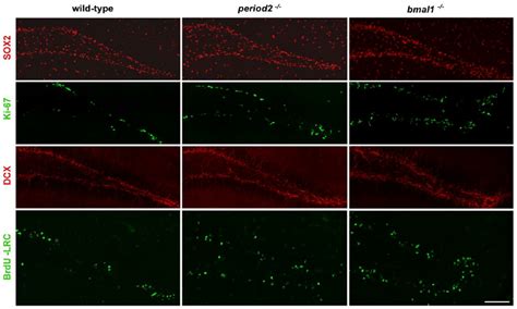 Figure S3. Neural precursors and newborn neurons are altered in... | Download Scientific Diagram