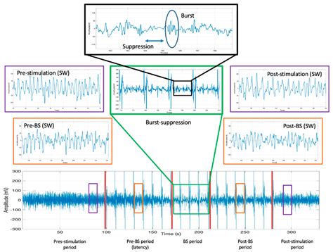 Brain Sciences | Free Full-Text | Electrical Stimulation in the ...