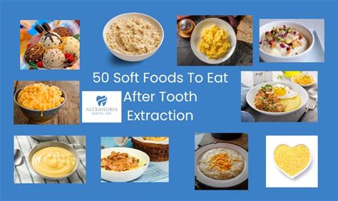 50 Soft Foods To Eat After Tooth Extraction