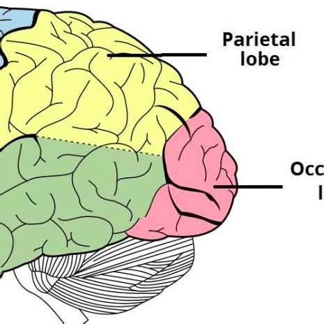 Diffuse Axonal Injury Gross