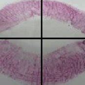 Division of lip into four quadrants. | Download Scientific Diagram