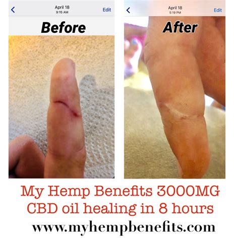 My Hemp Benefits! | YourFitnessNews.com