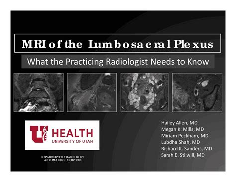 MRI of the Lumbosacral Plexus | Summaries Radiology | Docsity