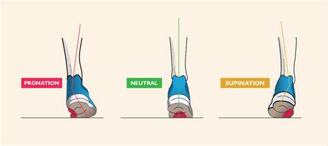 What is running pronation & gait analysis? | Pro:Direct Running