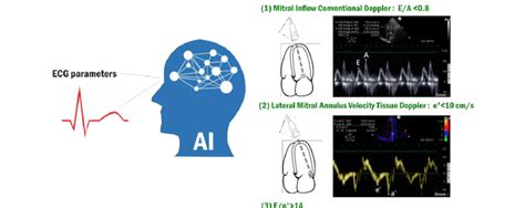 Schematic diagram of the proposed LVDD prediction system. | Download Scientific Diagram