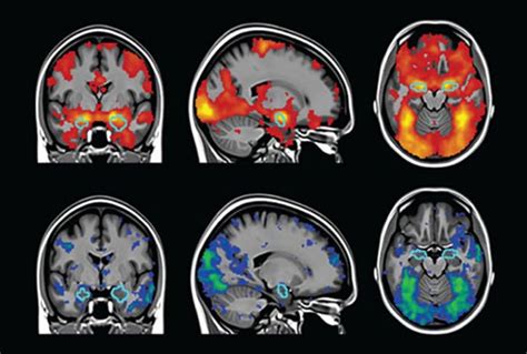 【60%OFF!】 Cellular Imaging Techniques for Neuroscience and Beyond www.dentellebyrama.com