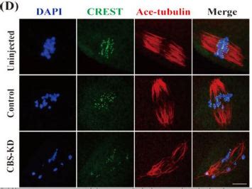 Anti-Centromere Protein Antibody