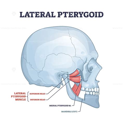 Lateral pterygoid muscle with superior and inferior parts outline ...