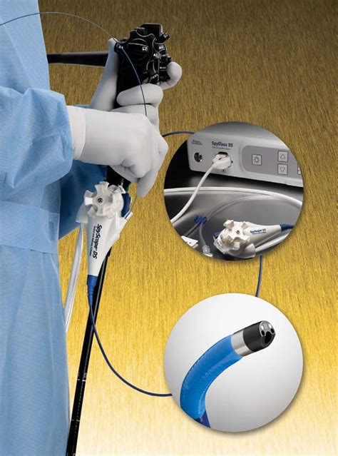 Endoscopy Product Catalogue 2017 - Boston Scientific