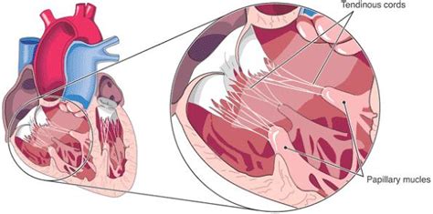 Papillary muscle - wikidoc