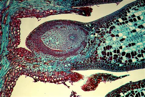 Pinus megasporangium with megasporocyte (or megaspore, if meiosis has already occurred) | Image ...