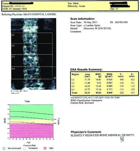 Understanding Your Bone Density Scan Results