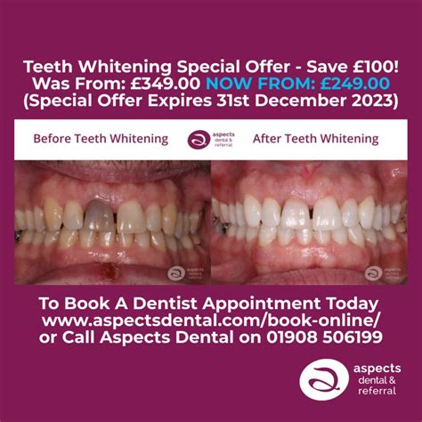 Milton Keynes Teeth Whitening Dentist Launches Teeth Whitening Special Offer For Autumn 2023