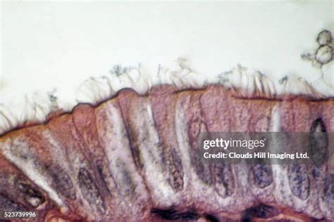 140 Cilia Microscopic Stock Photos, High-Res Pictures, and Images ...