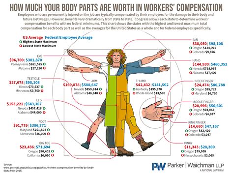 How Much Your Body Parts Are Worth In Workers’ Compensation #Infographic - Visualistan