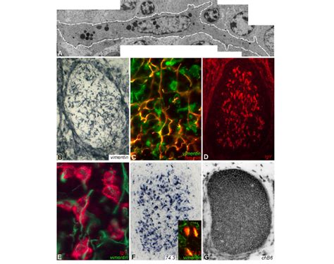 Germinal center. (A) Transmission electron micrograph of a follicular... | Download Scientific ...