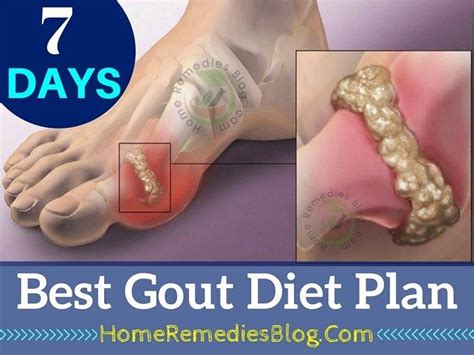 7 Days Gout Diet Plan For Fast Recovery | Gout diet, Gout meal plan, Gout