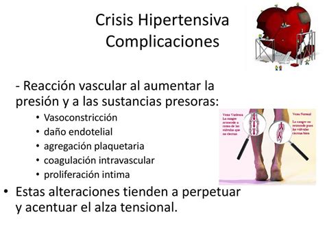 Emergencia Hipertensiva Urgencia Hipertensiva - ppt download