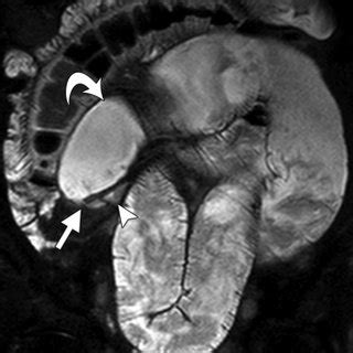 (PDF) Effectiveness of MR Enterography for the Assessment of Small ...