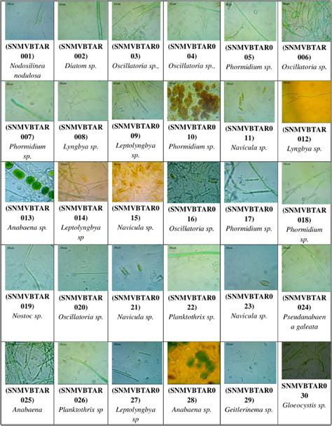 Microscopic observation of isolated microalgae. | Download Scientific Diagram