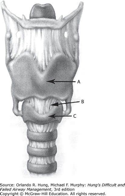 Cricothyrotomy | Anesthesia Key