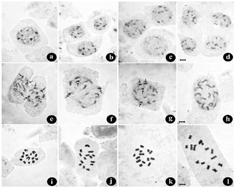 Orcein-stained interphase, prophase and metaphase stages of mitotic ...