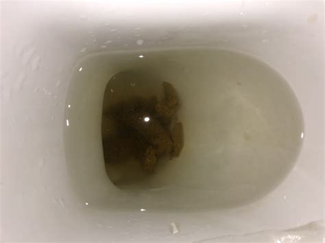 What Do Bubbles In Your Poop Mean at Edgar Nguyen blog