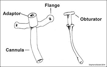 Parts of a Tracheostomy - Tracheostomy & Ventilator Program - Golisano ...