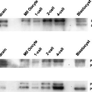 Glycogen synthase kinase-3 (GSK-3) a and b expression and... | Download Scientific Diagram