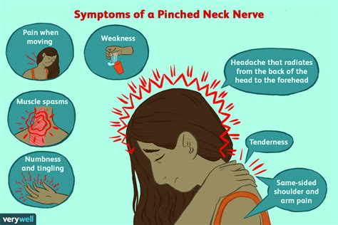 Pinched Nerve: Overview and More