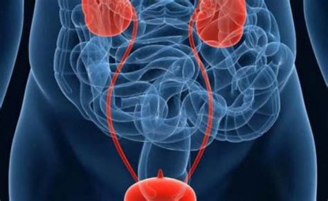 Case 14- Urological Diseases | Event listing | MedAll