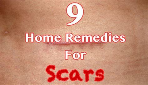 9 Home Remedies For Scars - Healthy Focus