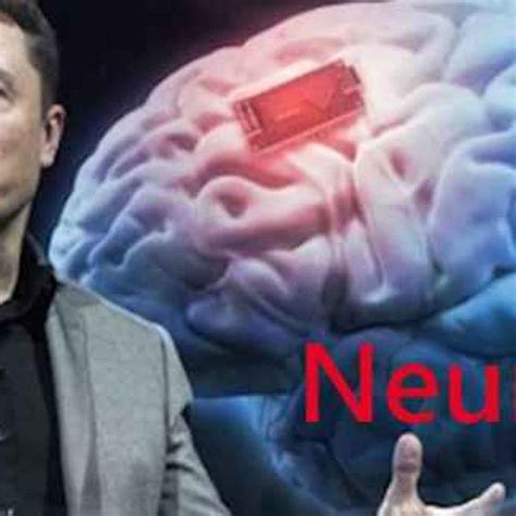 Neuralink la società di elon Musk che progetta interfacce cervello-macchina (Interfacce)