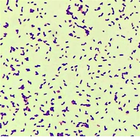 Listeria Gram Stain - halvedtapes