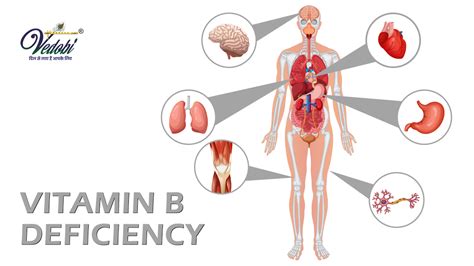 Vedobi - What is Vitamin B1 (Thiamine) deficiency? Know its Symptoms ...