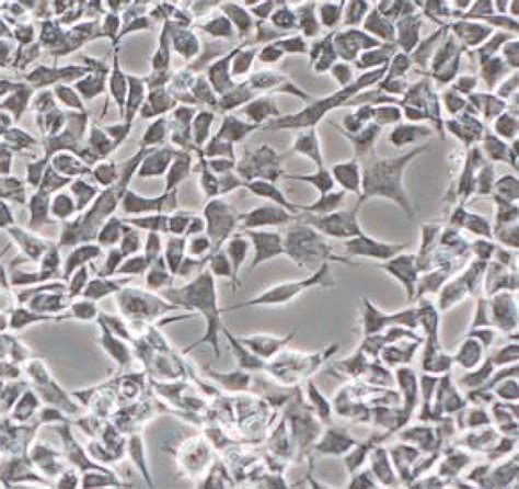 Cell Lines Expressing Fluorescent BACE1 – Cells Online